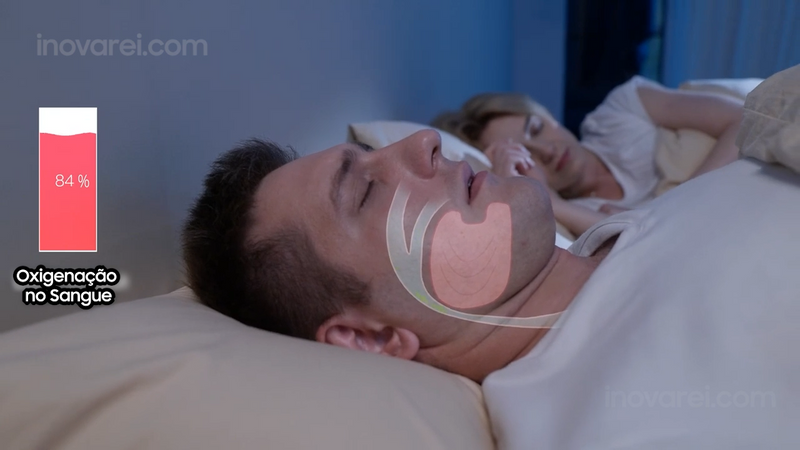 SonoFlux PRO® – Mini-CPAP Eletrônico Anti-Ronco e Apneia